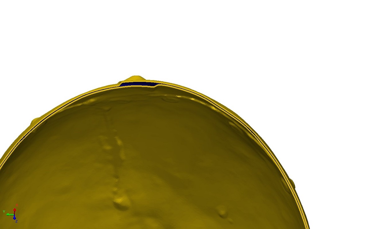 Yellow semicircle